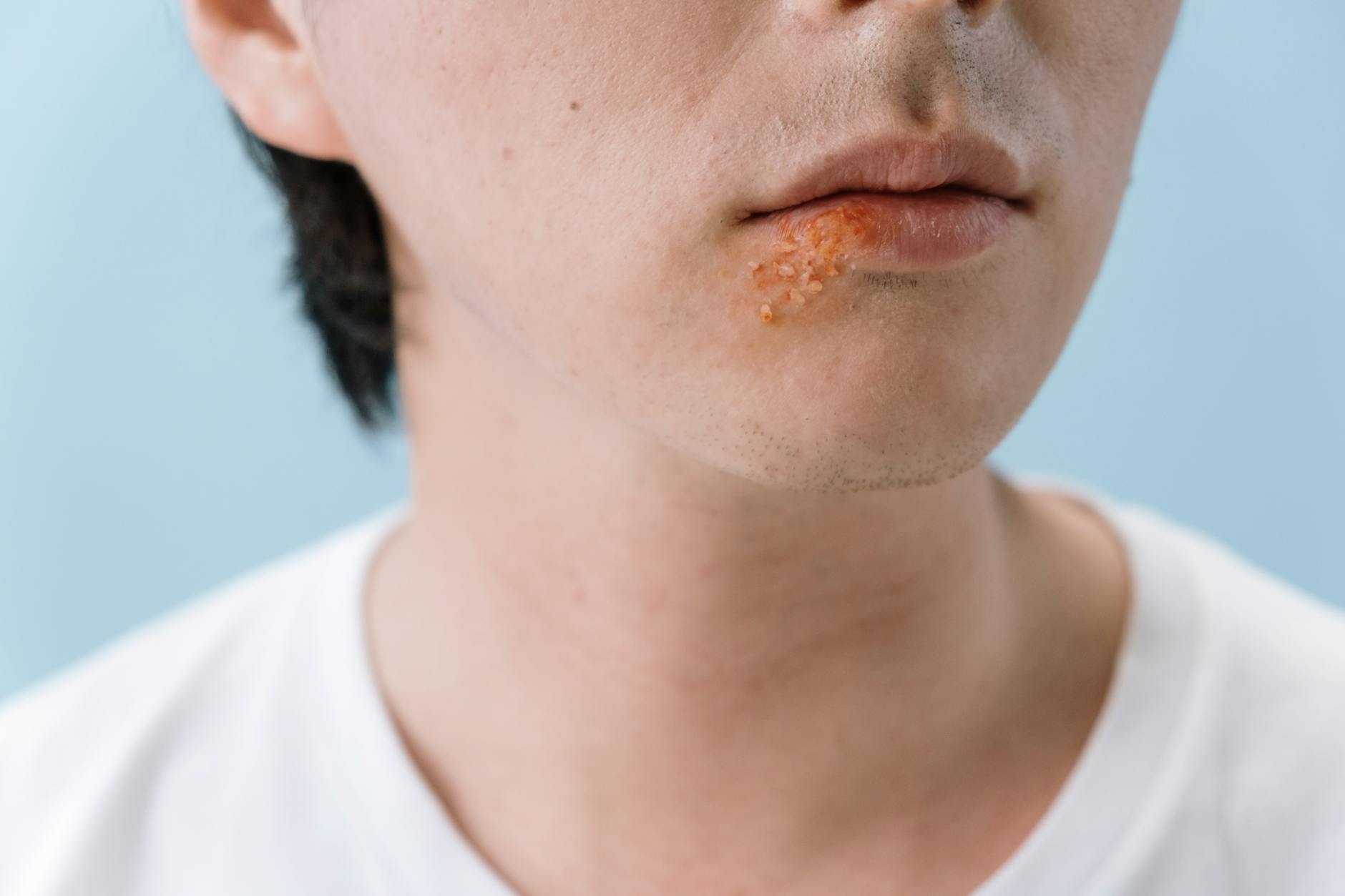 6 Skin Symptoms That Warrant a Visit to the Dermatologist